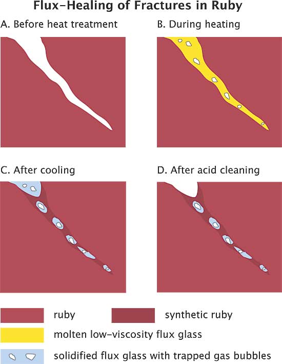 The mechanism of flux healing of a fracture in corundum. A. Open fracture/fissure, unhealed. B. During heat treatment, flux enters the fracture and dissolves the walls of the crack. C. During cooling, dissolved corundum recrystallizes in the crack, thus healing it closed. The newly crystallized ruby is essentially a synthetic ruby grown in the crack alone. It contains small pockets of now-solidified flux glass, along with some trapped gas pockets. For purposes of this diagram, the surrounding natural ruby and the synthetic ruby in the crack are shown in two different colors. In reality, no distinction can be seen between the surrounding ruby and the newly grown synthetic ruby. D. Any flux glass present on the surface can be dissolved away with acid. The synthetic ruby in the crack is unaffected by the acid, as is the ruby as a whole. (Illustration: R.W. Hughes; modified from Hänni, 2001, SSEF). Lotus Gemology.