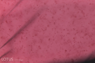 Iron-rich silk seen in transmitted light in this ruby from Tanzania’s Umba Valley.