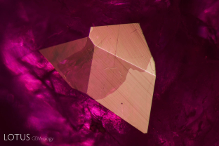 A large glass-filled cavity on the surface of this heated ruby from Mozambique. Lower-grade ruby from Mozambique is sometimes treated by both flux healing and glass infilling.