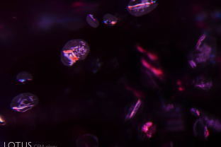 Rutile silk (high relief) with daughter crystals (lower relief) at the broad ends is a common feature of Mozambique rubies. Heat treatment often produces a breakdown, creating white spots or bubbles within the daughter crystals, as can be seen here.