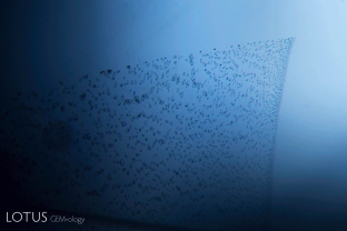 Fingerprints are similar to scars, representing the healing of earlier wounds. This example shows how a formerly open fissure has healed shut, with tiny flattened negative crystals being all that is left of the open space of the previous fissure.
