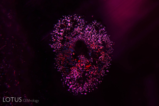 A lovely rosette surrounding a mica crystal decorates the interior of this ruby from Montepuez, Mozambique.