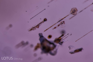 Unusual crystals of what may be apatite with attached growth tubes in a purple star sapphire from Sri Lanka.