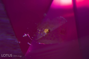 This small yellowish crystal in a Thai/Cambodian ruby offers proof that the stone has not been subjected to heat treatment. After heating, the crystal would melt into a glass.