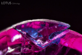 In this Burmese ruby, the stone was broken after polishing (probably during the setting process). To cover up the mistake, blue cement was used to glue the chip back in place. The cement quickly liquified when the hot point was touched to it, revealing the fraud.