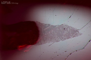 The lower luster of glass on the surface of this heated, fissure healed ruby, helps to separate the glass from the surrounding corundum, which has a higher luster.