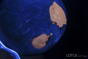 This black star sapphire from Chanthaburi, Thailand has large pits on the base filled with a brown dopping varnish. Long wave ultraviolet light shows the varnish fluoresces orange.