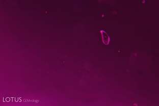 A ruby was sent to us for testing. It featured rutile silk, mica and some small rounded crystal grains. The inclusion evidence suggested that it could be from either Mozambique or Madagascar. The rounded grains could be amphibole or zircon. So we did micro Raman analysis on the grain pictured here. It turned out to be zircon. As zircon has not been found in Mozambique ruby, but is found in Madagascar ruby, this pointed to the stone as being from Madagascar.