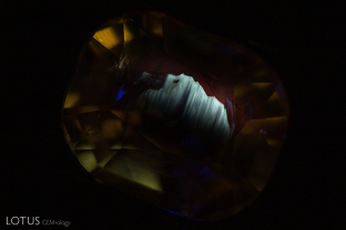 This yellow sapphire displays a striking angular, superficial chalky patch when viewed in shortwave UV illumination. This is the first time we have seen this reaction in a yellow sapphire that shows no signs of heat treatment, with all inclusions (intact negative crystals) and spectral information (strong 3160 in the infrared) pointing to an untreated gem. We have seen this reaction occasionally in untreated blue sapphires from Madagascar.