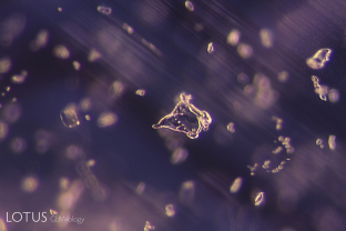This untreated pink sapphire from the Ilakaka area of Madagascar was part of a large parcel purchased from a miner by the author in 2005. It contains zoned clouds of fine rutile dust, rounded zircon crystals, and in the center, an irregular rounded crystal that was identified by micro Raman as anorthite, one of the end members of the plagioclase feldspar series.