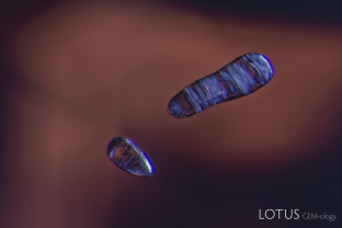 Two dolomite crystals trapped in spinel. Their identity was confirmed with micro Raman.