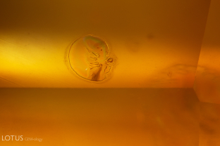 The melted crystal shown here provides strong evidence that its yellow sapphire host was heated.