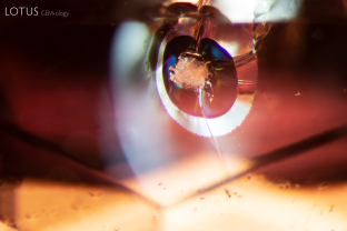 The large, reflective fissure around this crystal, likely mica, provides evidence that this sapphire has been heated. Mica crystals are particularly sensitive to heat.