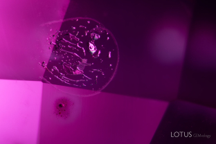 On rare occasions, we encounter synthetic gems that have been subjected to heat or diffusion treatment. a healed fissure with bubbly, rounded channels and concentration of diffused color around a pit in a diffusion-treated synthetic ruby. 