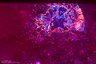 This Thai/Cambodian ruby displays thin films with drippy, irregular edges and a melted crystal inclusion featuring an immobile gas bubble. These features act as evidence that the stone has been heat treated.