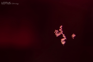 A cluster of unidentified crystals in a Vietnamese spinel.