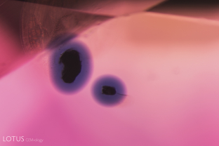 During heat treatment, primary rutile crystals leech titanium into the surrounding corundum, coloring it blue. This process is termed “internal diffusion.”