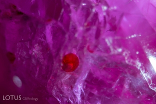 This high-temperature ruby bead necklace was impregnated with red wax. Here the wax has filled a small cavity in one of the ruby beads. One can clearly see a gas bubble in the red wax.