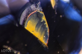Yellow epigenetic limonite stains within a fissure of a sapphire from Sri Lanka. These suggest the stone has not undergone heat treatment, for at just a few hundred degrees centigrade the limonite will convert to reddish hematite.