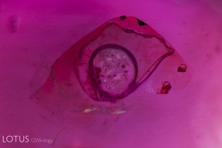 This round gas bubble is suspended in a small cavity on a Burmese ruby which has some filler substance (this could be resin or oil). Oil is often used to mask the appearance of fissures and cavities.